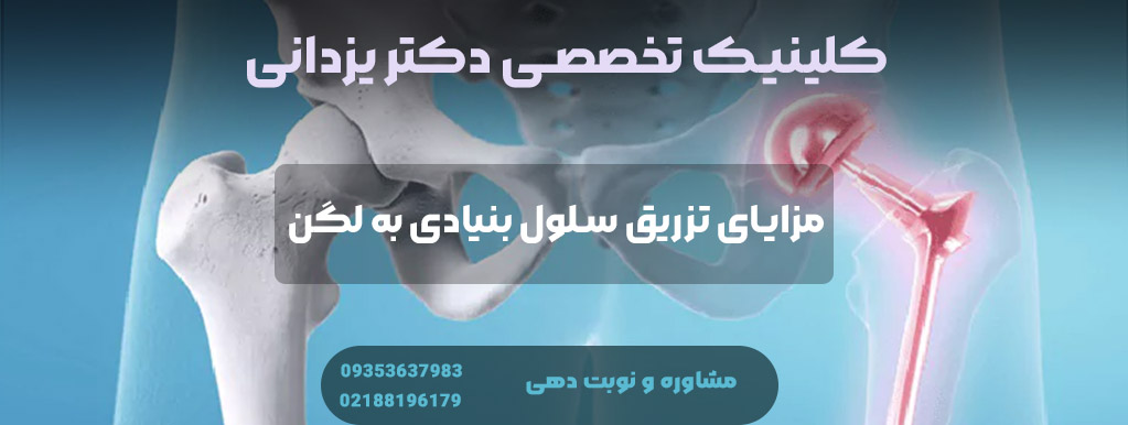 مزایای تزریق سلول بنیادی به لگن